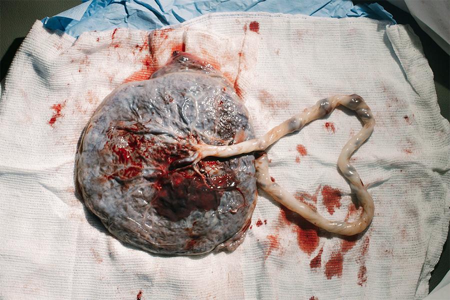 joao-paulo-de-souza-oliveira-RXG9IQxfhec-unsplash