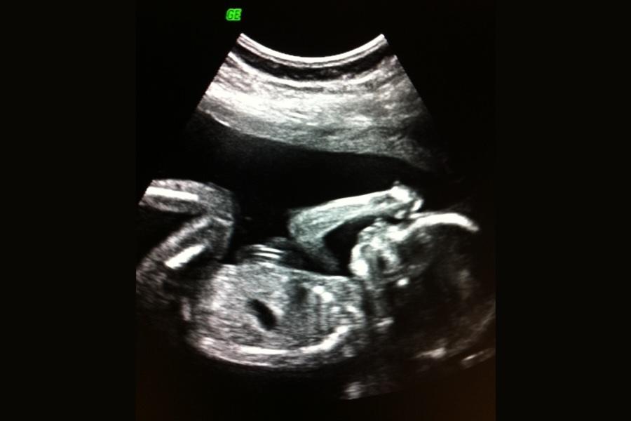 Fetal_diagnostic_900x600